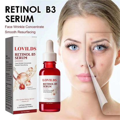 (🔥🔥🔥Limited time offer last 30 minutes) LOVILDS™ RETINOL B3 SERUM